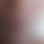 Mucocutaneous leishmaniasis: in an HIV-infected patient; severe, nonpainful swelling of the upper...