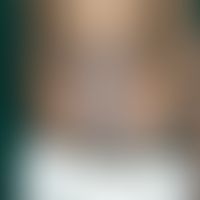 Dermatitis kontaktallergische: chronische lichenifizierte Dermatitis mit&nbsp; nachgewiesener Nic...