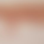 Livedo racemosa: section through the skin (cross section through striated erythema). vessel compl...