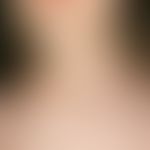 Lymphangioma cavernosum (subcutaneous): encircles the 7.0 x 6.0 cm large, soft, elastic (spongy),...