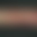 Purpura senilis: General view: Multiple, different ages, extensive bleeding into the skin on the ...