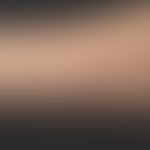 Hidrozystome: multiple symptomlose, deutlich prominente, hautfarbene Knötchen. Diagnose nach biop...