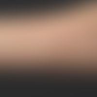 Hidrozystome: multiple symptomlose, deutlich prominente, hautfarbene Knötchen. Diagnose nach biop...