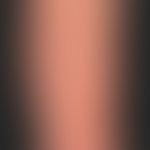 Chronischer Sonnenschaden der Haut: Trockene grob gefelderte, atrophische&nbsp;Haut mit solaren L...