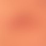 Follikulitis: gelbliche follikuläre Pusteln.
