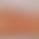 Solitary, acute, flat, moderately sharply bordered, hardly elevated, skin-coloured, little increa...