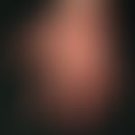 Lichen planus classic type: unusual infestation of the palms with itchy, red, in places confluent...