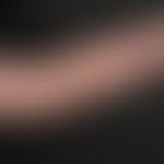 Naevus flammeus lateralis.&nbsp;Kongenitale, generalisierte, fleckige Erytheme am linken Arm bei ...
