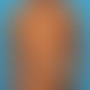 Ichthyosis lamellosa, autosomal-rezessiv mit erhaltener Transglutaminaseaktivität
