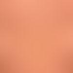 Flash lamps: Depigmentation after treatment.
