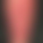 Papillomatosis cutis lymphostatica:&nbsp;flächenhafte,&nbsp;nach distal scharf begrenzte, nach pr...
