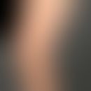 Pruritus brachioradialer: frequently occurring unpleasantly prickly itching on the extensor forea...