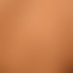 type i neurofibromatosis, peripheral type or classic cutaneous form. numerous deep-seated soft pa...