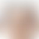 Etagendifferenzialdiagnose an der Hand bei rheumatoider Arthritis und der&nbsp; psoriatischen Pol...