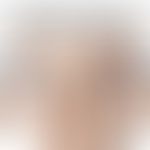 Etagendifferenzialdiagnose an der Hand bei rheumatoider Arthritis und der&nbsp; psoriatischen Pol...