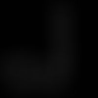 Structural formula of melatonin.
