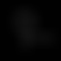 Strukturformel des Pyridin-4-carbonsäure-hydrazids (Isoniazid).
