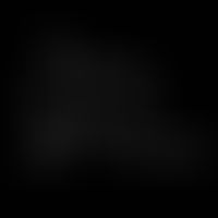 Structural formula of aucubin; aucubigenin, the antibiotically active aglycone of aucubin, is for...