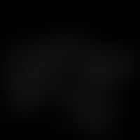 Structural formula of the proazulene matricin, which is degraded by hydrolytic cleavage during st...