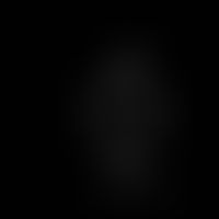 Structural formula of anisaldehyde
