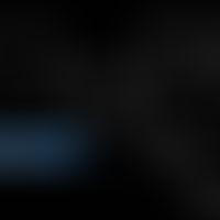 Strukturformel von Epigallocatechingallat

