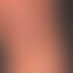 Psoriasis vulgaris chronisch-stationäre (Plaque-Typ):&nbsp;Seit mehreren Jahren bestehende, wenig...