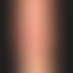 Tinea corporis:&nbsp;seit mehreren Monaten bestehende, solitäre, ringförmige, scharf begrenzte, a...