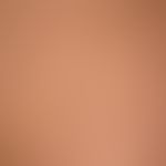 Lichen planus exanthematicus. itchy exanthema existing for about several months with barely pinhe...