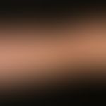 Vaskuläre (kapilläre) Malformation (sog. Naevus flammeus):&nbsp;Kongenitale, generalisierte, unre...