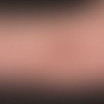 Kaposi's sarcoma epidemic: Dissemination of the angiosarcoma in the skin. Here individual nodes o...
