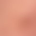 Kaposi's sarcoma endemic: Detailed view. reddish-brown, surface-smooth plaques and nodules. consp...