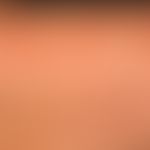 Papules, reddish brown: multiple, not itchy 0.2-0.4 cm large, smooth, roundish papules, linear ar...