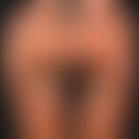 HanHand-Fuß-Mund-Krankheit:&nbsp;seit etwa 1 Woche, &nbsp;schmerzhafte, Bläschen,Pusteln und Pape...