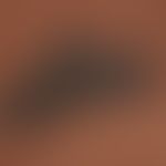 Naevus, melanozytärer, kongenitaler.&nbsp;Hier dargestellt in farbiger Haut. Detailaufnahme. Seit...