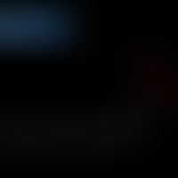 Strukturformel von Glyceryl arachidate (Glycerinmolekül rot gezeichnet)

