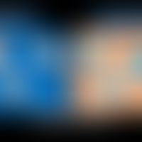 Emulsionstypen: Zusammensetzung einer Öl-in-Wasser-und einer Wasser-in -Öl-Emulsion. &nbsp;
