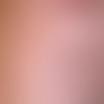 Transitorische akantholytische Dermatose (M.Grover): seit wenigen Wochen bestehendes, kaum&nbsp; ...