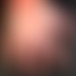 Hand-Fuß-Mund-Krankheit:&nbsp;seit etwa 1 Woche, &nbsp;schmerzhafte, Bläschen, Blasen&nbsp; und P...