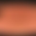 Hyperpigmentation caloric: forseveral years, irregular heat applications due to back problems, th...