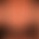 Melanozyt:&nbsp; normale (physiologische) Bräung der Haut durch UV-Strahlen.
