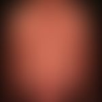 Erythrodermie:&nbsp;seit Jahren bestehende Pityriasis rubra pilaris. Schubweise Aktivität der Erk...