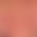 Rosacea papulopustulosa: zentrofazial lokalisierte flächige Rötungen, entzündliche Papeln und Pus...