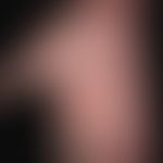 Pustulose, akute generalisierte exanthematische: großflächiges, nach Medikamenteneinnahme akut au...