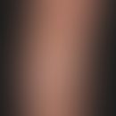 Pityriasis alba: large, non-symptomatic (no itching), blurred and irregularly limited white patch...