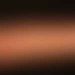 Generalized cGVHD: chronic, generalized, poikilodermatic skin changes, with extensive hardening a...