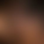 Pemphigus vulgaris: seit mehreren&nbsp;Jahren schubweise verlaufende, entzündliche Plaques mit fl...