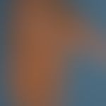 Eczema atopic (in dark skin): here as partial manifestation of a generalized (face, neck, hands, ...