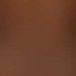 Generalized atopic eczema: large-area, chronic. generalized seizure-like itchy dermatitis with mu...