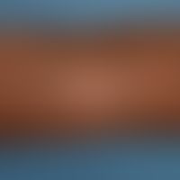 Eczema atopic: Skin lesions in a 22-year-old woman with generalized atopic eczema. In the area of...