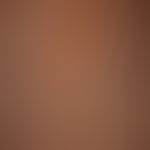 Generalized atopic eczema: large-area, chronic. generalized seizure-like itchy dermatitis with mu...